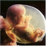 Abortion - Abortion A little fetus