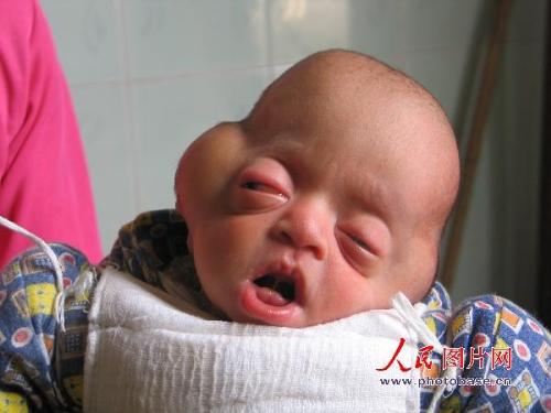 an chinese baby many people called alien -  the baby was born like this, and many villagers startled at his look and some of them even say that it's not a baby, it's alien.
