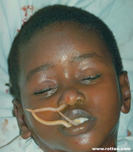 helppppp - help this child!!!!!!!
