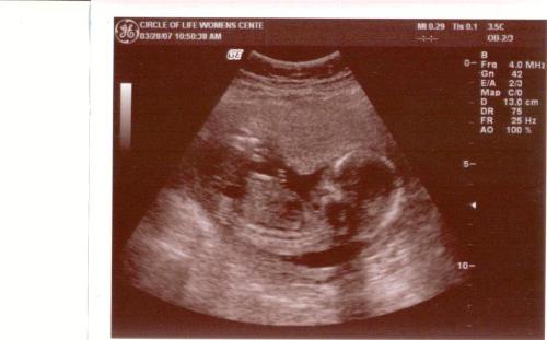 16 weeks-it's a boy! - 16 weeks