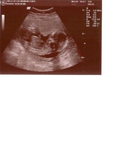 16 weeks - 16 weeks it's a boy!