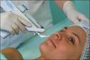 hair removal - hair removing