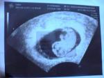 13th week - my baby when he was 13 weeks old