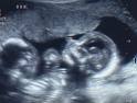 ultrasounds - do you rely on your results?