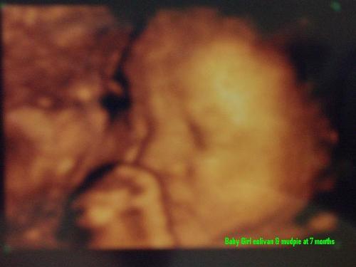 baby girl eolivan - my baby girl at 7 months 4D ultrasound