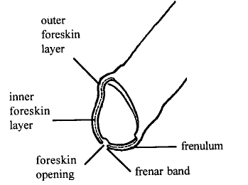 pennis 3 -  pennis 3