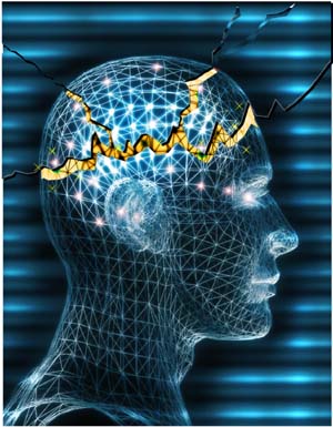 Epilepsy - Epileptic part of brain