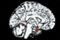 Brain - Picture of brain.