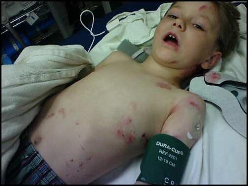 Cody in Hospital, My poor baby - Cody in Hospital brought in by ambulance.