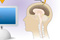 Brain - Brain for debate.