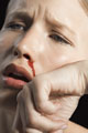 nosebleeding - a woman suffering from nosebleeding nosebleeding - a woman suffering from nosebleeding