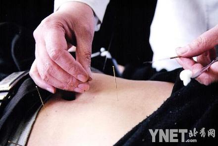 Acupuncture - Chinese medicine how do you like it?
