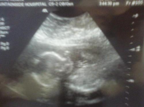 My baby girl!! - Jayda Lyn at 5 months pregnant. I think this is the cutes sonogram ever!!