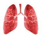 Healthy/Lungs - The Lungs of a person who does not smoke.