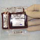 cord blood - Donating your baby&#039;s cord blood