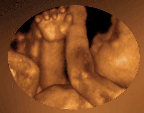 ultrasound - 4d ultrasound of a baby inside a womb