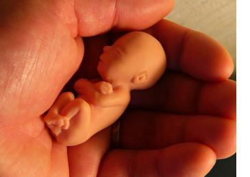 female fetus - female infanticde is common in india, as sex determination tests are still done by sonography