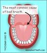 brush your teeth - brush your teeth to avoid halitosis