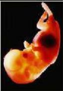embryo or a fetus - a fetus photo taken visualize the image of a fetus inside the womb.