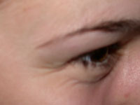 wrinkles - do you have?