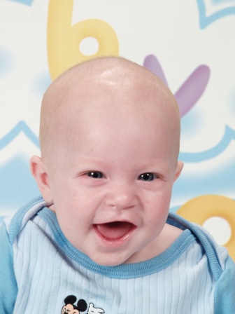 Charlie - Charlie at age 3 months