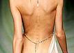 Model - Photo of a frighteningly thin model. Model - Photo of a frighteningly thin model.