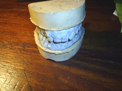 A dental cast - A dental cast. This was made when myhusband's bridge needed to be repaired. We kept the cats just because it is so strange and creepy!