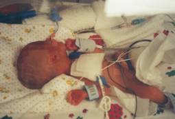 Preemie baby - my son a couple days old