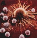 cancer cell under attack - cancer cell being attacked by killer T cells