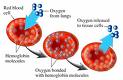 anemia - this photo is from healthlibrary.epnet.com