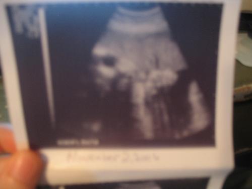 Rubin jr - my son