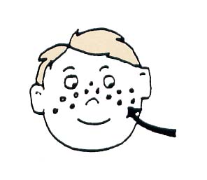 do you know how freckles are formed???? - freckles are simply a bunching up of those melanocytes in spots.