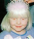 White Albino - White Albino Little Girl