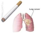 lungs - smoking leads to cancer lungs - smoking leads to cancer
