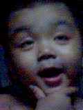 smile theraphy - this is the one which shows the best face for a smile therapy..hehehe