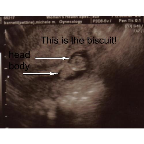 my first ultrasound--9 weeks and 4 days - this is my first ultrasound at 9 weeks and 4 days--it is really hard to tell what is what, but if you know what a fetus looks like, you can tell in this picture! I am 16 weeks pregnant now-July 6, 2007.
