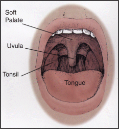 snoring - It is a mouth showing what causes snoring at night during sleep