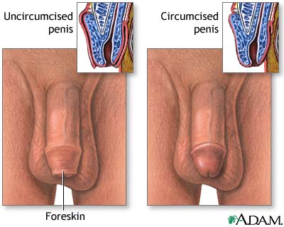 circumcised versus uncircumcised - difference between circumcised and uncircumcised