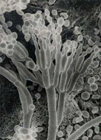penicillium - GOOD gifted gift........