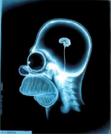homer simpson&#039;s xray - this just shows how small his brain is. lol. :0