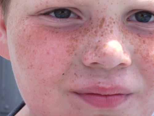 picture of a childs face - This is a picture of a robust boy, with freckles, and very child-like.