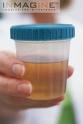 Urine - This is urine in a cup!
