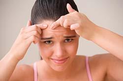 pimple! - teenage girl popping zit (eww)!
