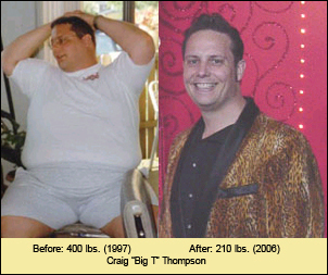 a gastric bypass patient - better look?maybe!