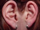 ears - The ear is the sense organ that detects sounds. The vertebrate ear shows a common biology from fish to humans, with variations in structure according to order and species. It not only acts as a receiver for sound, but plays a major role in the sense of balance and body position.  The word 'ear' may be used correctly to describe the whole vertebrate ear, or just the visible portion. In most animals, the visible ear is a flap of tissue that is also called the pinna. The pinna may be all that shows of the ear, but it serves only the first of many steps in hearing and plays no role in the sense of balance. In people, the pinna is often called the auricle. Vertebrates have a pair of ears, placed symmetrically on opposite sides of the head. This arrangement aids in the ability to localize sound sources.