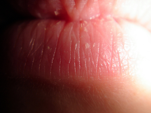 dry lips - very dry lips dry lips - very dry lips