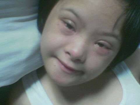 thinking about down syndrome - this is my 'couz and she has this down syndrome thing.. people refer to as mongoloids.. but really, it's not the right term for it..   at first time, when we were kids, i really wanted to somehow get to know her, and turns out, i don't understand her at all!.. but they visit us yearly and soon, i began to be at home with her, and so was her to me.. now i find myself attached and well.. she's irresistably loving and charming, once you get to know her.. c:  we call her at home, jooja..heheheh..check out for her other photos.. you just might have fun when she strikes her pose! c: