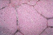 Histology - Liver lobules and hepatocytes.