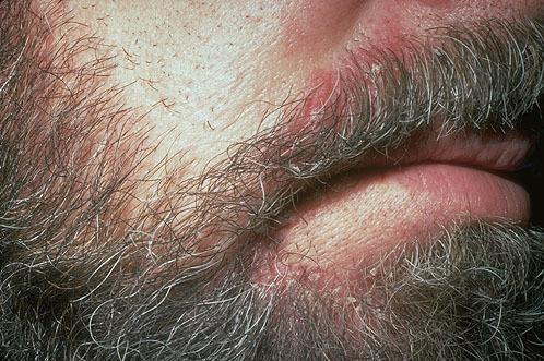 men&#039;s facial hair - this is a picture of a man with a thick beard or facial hair.