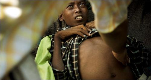 Poverty - An African child suffering from starvation.